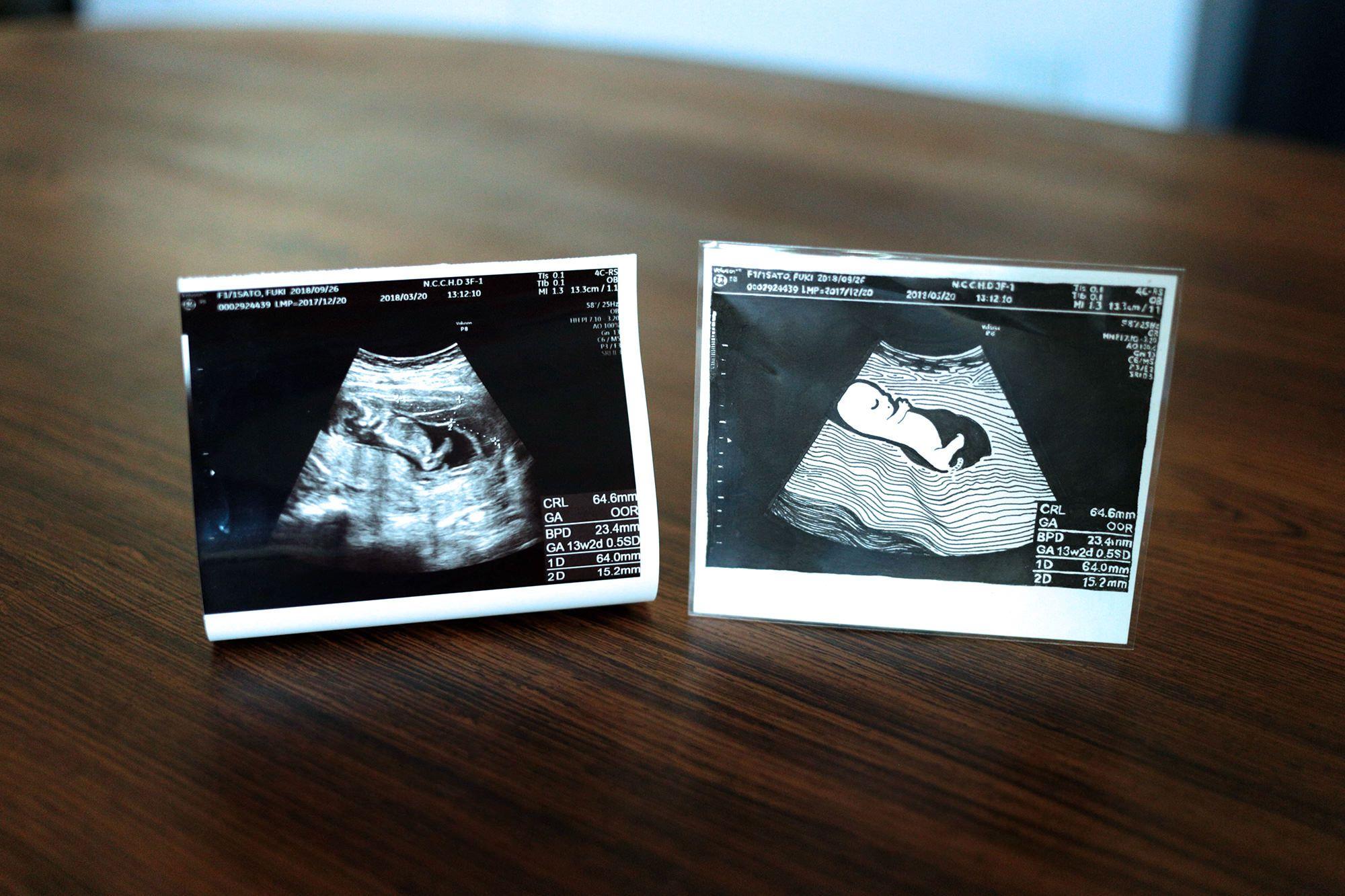 エコー写真をイラストにするサービス「エコー画」を発表